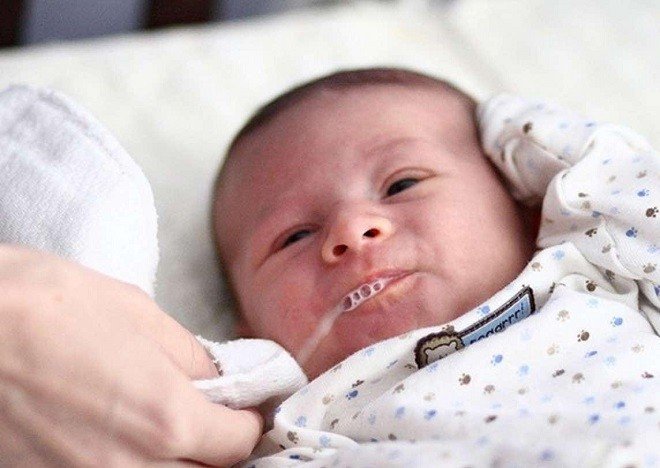 cải thiện trớ sữa ở trẻ sơ sinh