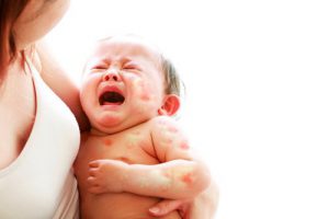 Bố mẹ cần làm gì khi trẻ sơ sinh dị ứng sữa?