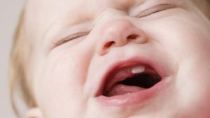 Trẻ mọc răng nào trước? Cách chăm sóc răng cho trẻ giai đoạn mọc răng?