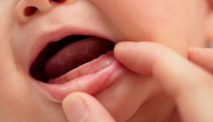Trẻ mọc răng quấy khóc: Nguyên nhân và cách cải thiện