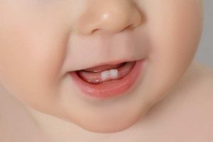 Trẻ mọc răng sốt mấy ngày thì hết?